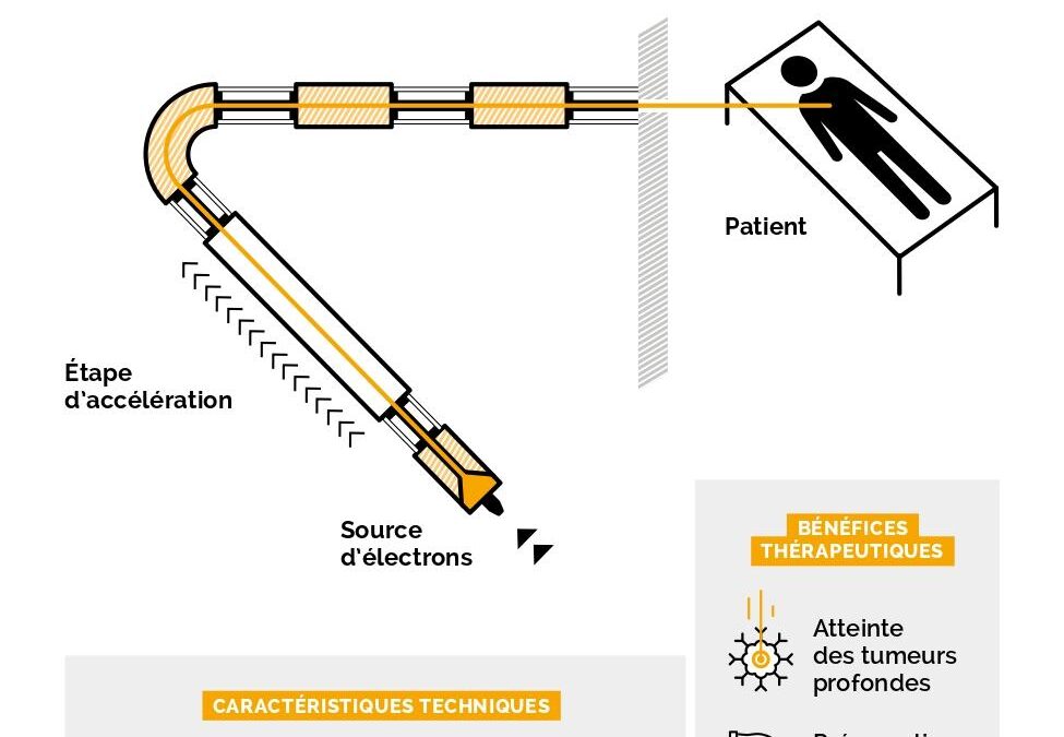 La nouvelle ère de la Radiothérapie